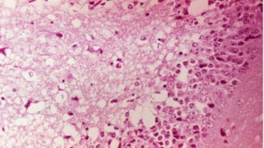 First Commercially Available Venezuela Equine Encephalitis Virus (VEEV) Protein Announced